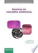 Avances En Vasculitis Sistémicas