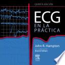 Ecg En La Pr?ctica