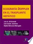 Ecografía Dopple En El Trasplante Hepático