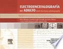 Electroencefalografía Del Adulto