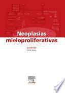 Neoplasias Mieloproliferativas