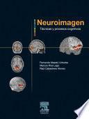 Neuroimagen. Técnicas Y Procesos Cognitivos