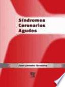 Síndromes Coronarios Agudos