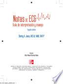 Notas De Ecg. Guia De Interpretacion Y Manejo